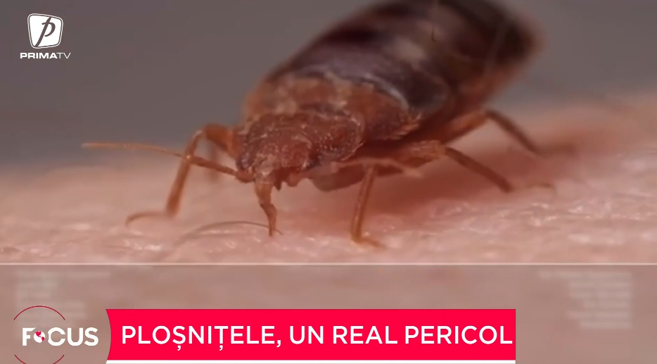 plosnitele,-un-real-pericol.-ce-spun-medicii