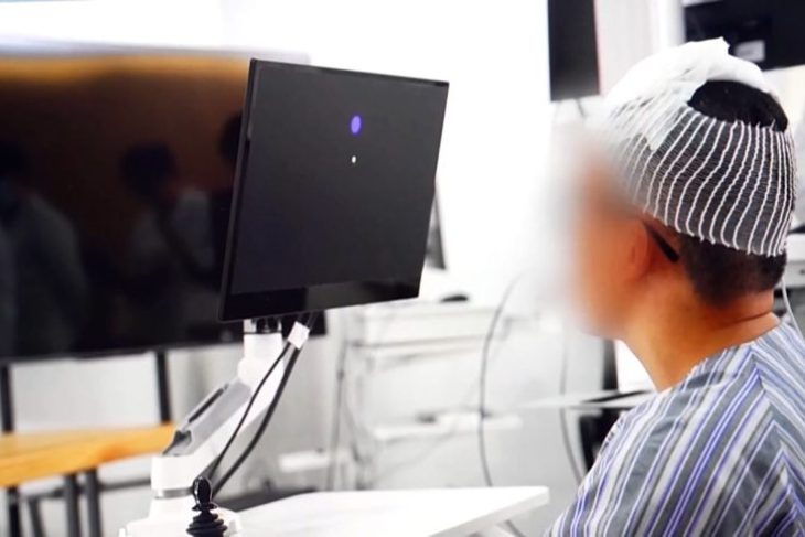 barbat-paralizat-isi-controleaza-scaunul-cu-rotile-si-gadgeturile-doar-cu-mintea,-la-cinci-zile-dupa-un-implant-cerebral-in-china