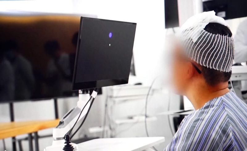 barbat-paralizat-isi-controleaza-scaunul-cu-rotile-si-gadgeturile-doar-cu-mintea,-la-cinci-zile-dupa-un-implant-cerebral-in-china