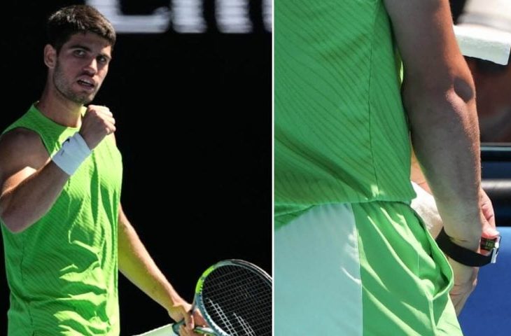 alcaraz,-obligat-sa-si-scoata-bratara-inteligenta-in-timpul-meciului.-motivul-invocat-la-australian-open