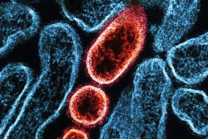 controale-amanuntite-in-aeroporturi-din-asia-dupa-ce-india-anunta-noi-infectii-cu-virusul-nipah