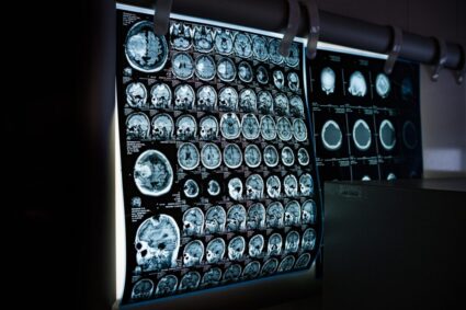 surpriza-uriasa-a-unui-pacient-in-varsta-de-31-de-ani:-a-aflat-ca-are-un-organ-intern-in-plus