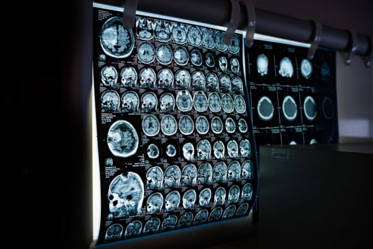 surpriza-uriasa-a-unui-pacient-in-varsta-de-31-de-ani:-a-aflat-ca-are-un-organ-intern-in-plus