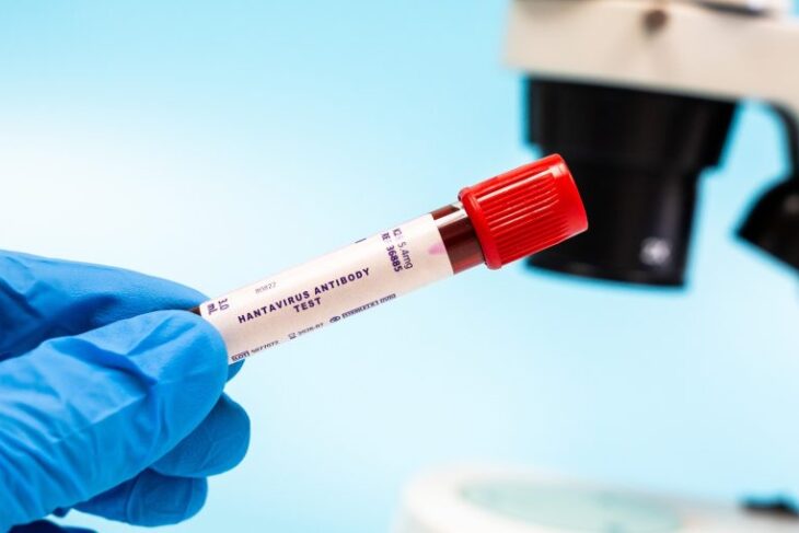 lista-actualizata-a-tarilor-afectate-de-hantavirus-in-2026.-unde-circula-cele-mai-periculoase-tulpini-si-ce-risc-de-infectare-exista