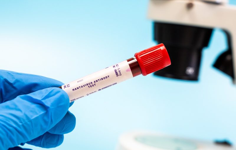 lista-actualizata-a-tarilor-afectate-de-hantavirus-in-2026.-unde-circula-cele-mai-periculoase-tulpini-si-ce-risc-de-infectare-exista