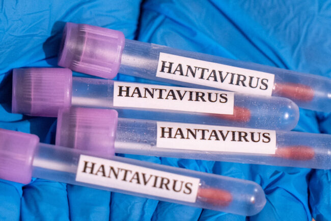care-sunt-simptomele-hantavirusului.-epidemia-ar-fi-ajuns-la-granita-romaniei