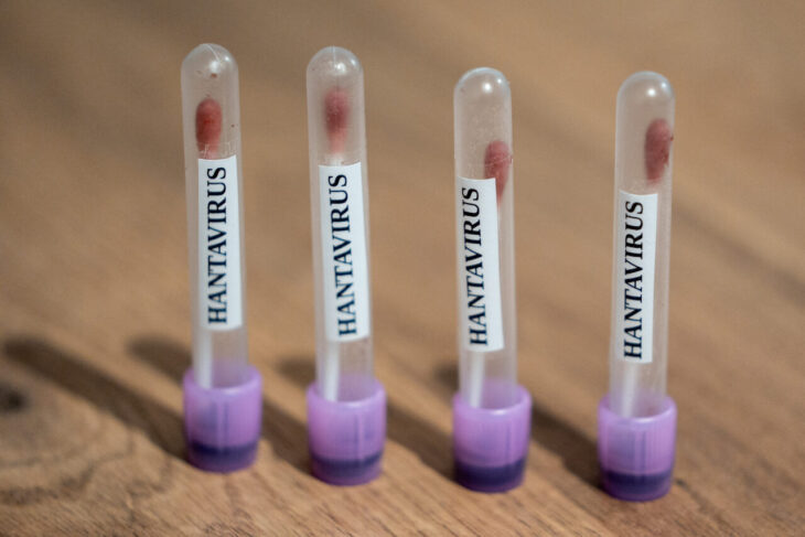 pacienta-infectata-cu-hantavirus,-in-stare-grava.-primeste-oxigen-printr-un-plaman-artificial
