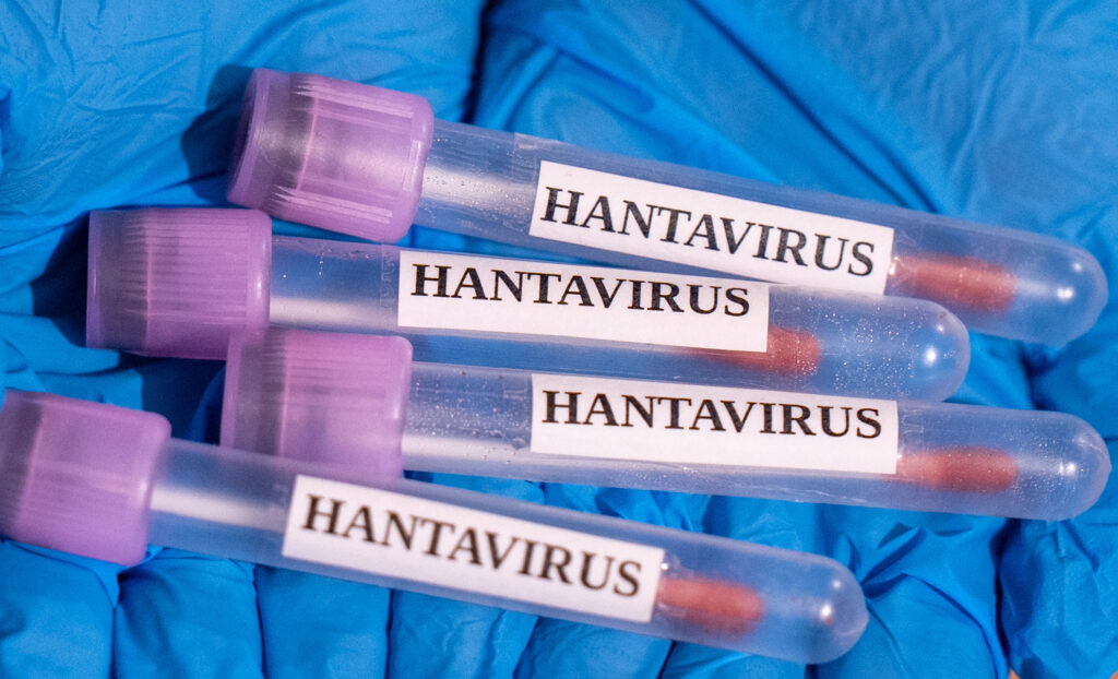 femeia-franceza-infectata-cu-hantavirus-ramane-in-stare-grava-la-terapie-intensiva