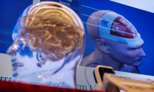china-provoaca-neuralink-cu-o-tehnologie-fara-operatii-pe-creier.-pariul-care-poate-schimba-viitorul-implanturilor-cerebrale