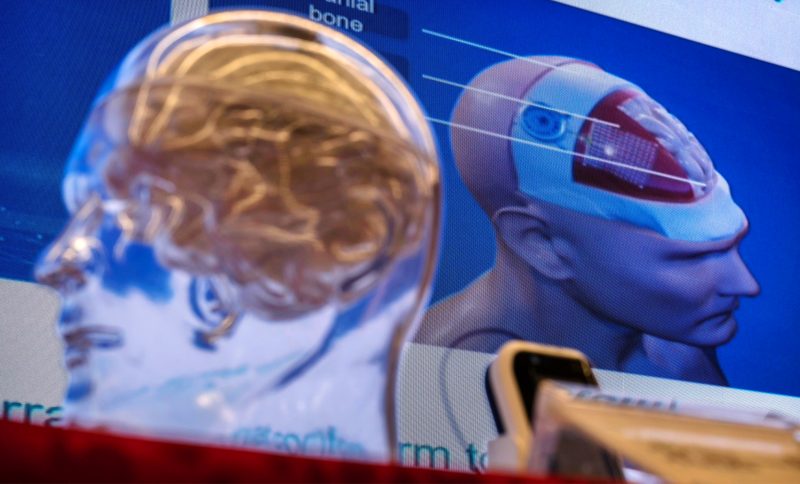 china-provoaca-neuralink-cu-o-tehnologie-fara-operatii-pe-creier.-pariul-care-poate-schimba-viitorul-implanturilor-cerebrale